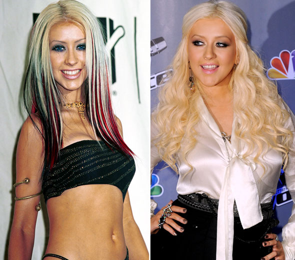 Antes e depois de cantoras famosas
