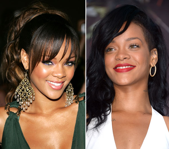 Antes e depois de cantoras famosas