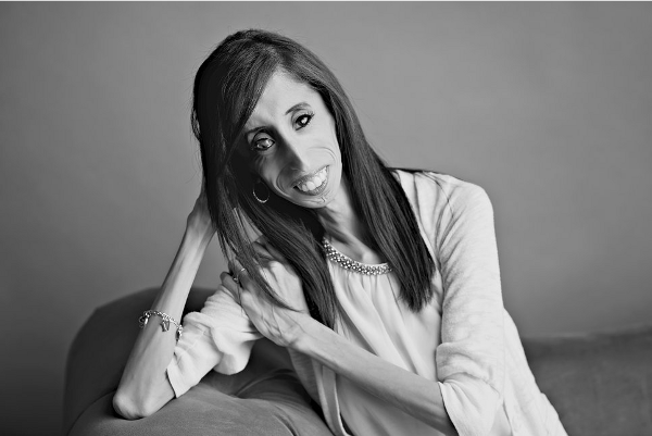 Lizzie Velasquez