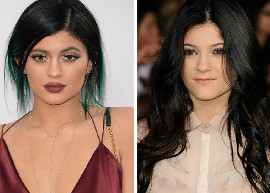 Kylie Jenner revela o segredo sobre o aumento de seus lábios
