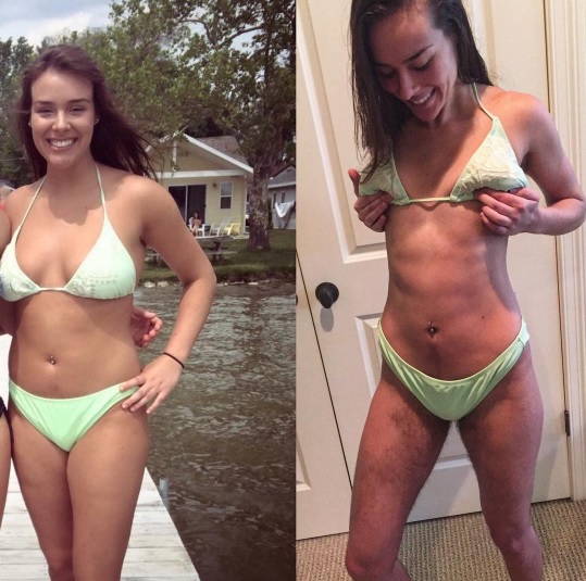 imagens de antes e depois da blogueira que deixou de se depilar por 1 ano