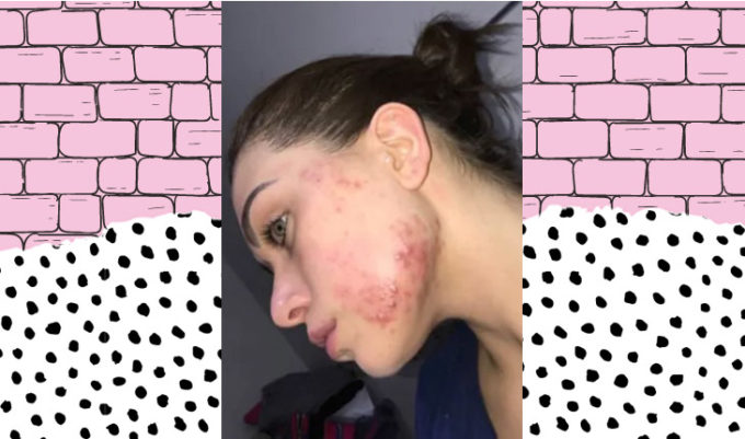 pele da flavia pavanelli